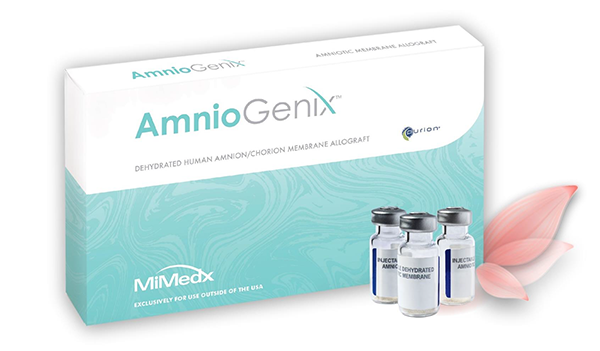 AmnioGenix