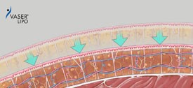 保護された細胞組織の再形成及び血行再建が皮膚の収縮を促進